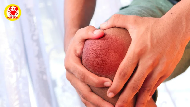 Hỗ trợ sức khỏe xương khớp