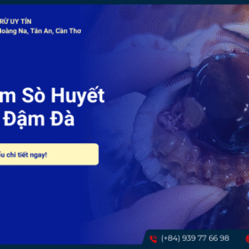 Sò huyết lacoste